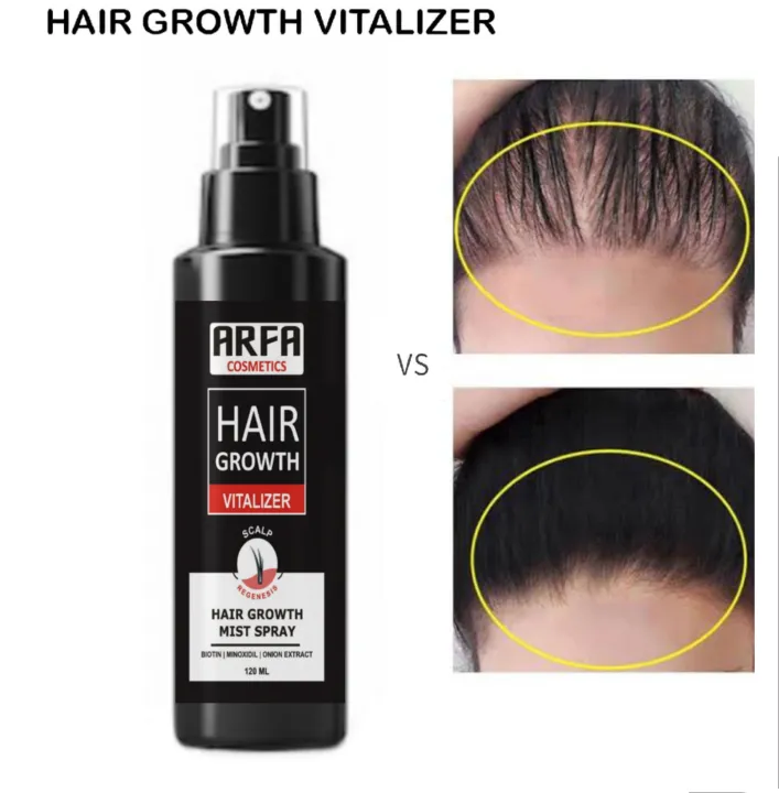 Arfa Cosmetics Minoxidil 5% Hair Growth Minoxidil Spray Hair Tonic For Hair Care Hair Loss and Hair Growth Premium Hair Care Product Women and Men All Hair Types 120Ml