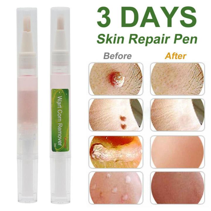 Skin Tag Remover Mole Remover Skin Tag Removal 3ml