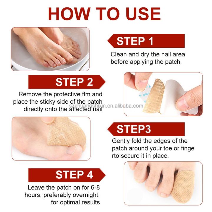 1%20SOLUTION%20SHOP%20Nail%20Fungal%20Treatment%20Patch%20%7C%20Anti%20Fungus%20Toe%20Nail%20Repair%20Strips%20%7C%20Overnight%20Hydrogel%20Patch%20for%20Yellow%20Nails,%20Cracked%20&%20Brittle%20Nail%20Care%20%7C%20Fast%20Nail%20Restoration%20%7C%2021%20Patches%20%7C%20Anti%20Infection%20Nail%20Protector%20for%20Healthy%20Shiny%20Toenails%20-%20Image%207