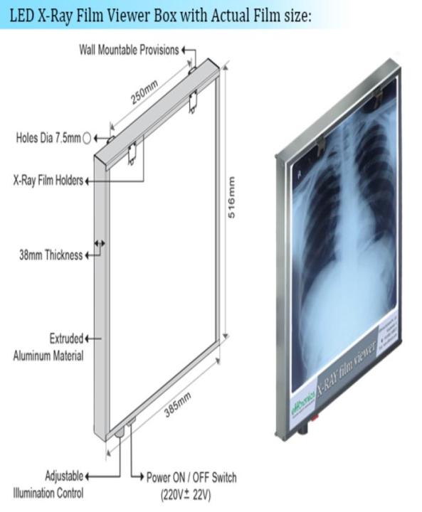 Mon Ray Screen X Ray Film Viewer LED Illuminator Single Connection Screen Size 370X422 ...