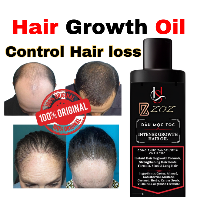 hair growth oil for men and women - Hair growth and Hair care oil - Made in Vietnam hair growth oil