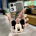 VIVO Y03 2024 Luxury Cute Mickey Mouse Casing Clear Candy Silicon Case Camera Protector Soft Case Cover. 