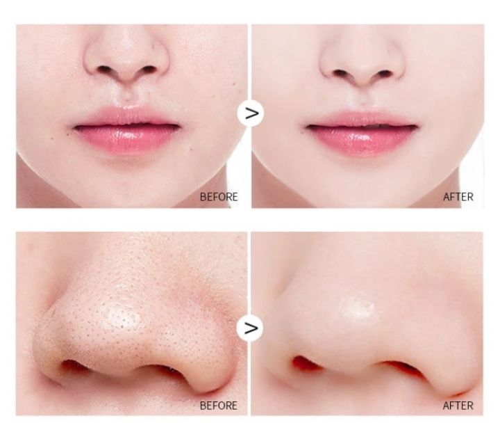 Original%20Green%20Mask%20Stick%20%E2%80%93%20Deep%20Cleansing,%20Oil%20Control,%20Blackhead%20Removal,%20Acne%20Treatment,%20and%20Smooth%20Glowing%20Skin%20-%20Image%203