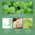 Soft Microacid Centella Asiatica Bubble Mask Moisturizing Gentle Cleansing Foaming Cream Face Skin Acne Treatments Care. 