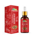 Rosehip Oil – For Anti Acne,Scars,Aging [روز ہپ]. 