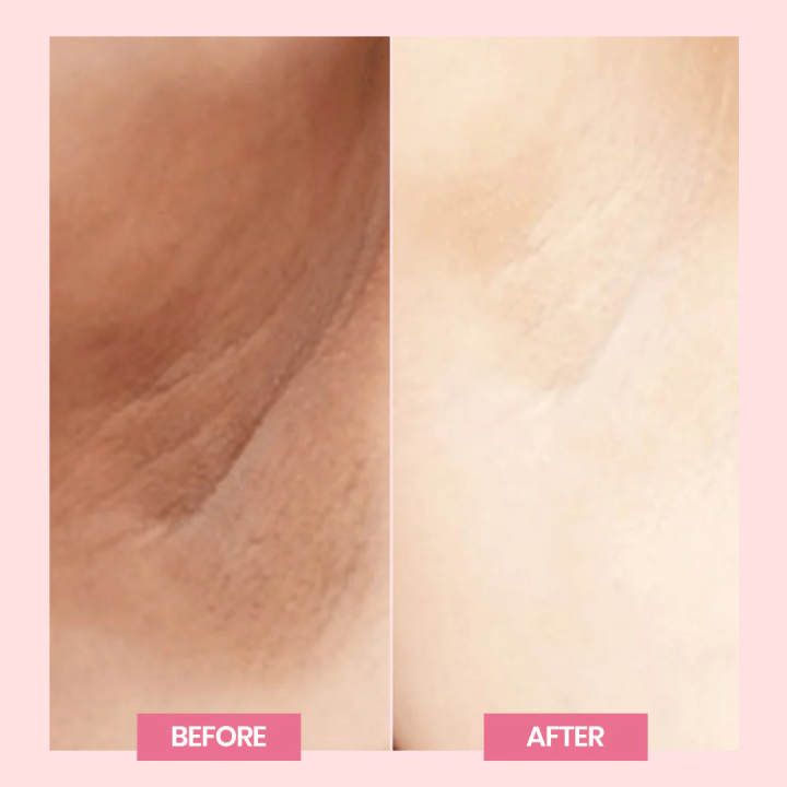 Wisdom%20Therapeutics%20Reborn%20Cream%20Advanced%20White%20Beauty%20Skin%20Cream,%20Night%20Cream,%20Brightening%20Cream%20for%20Private%20Parts%20&%20Lightens%20Uneven%20Skin%20Tone%20-%20Image%205