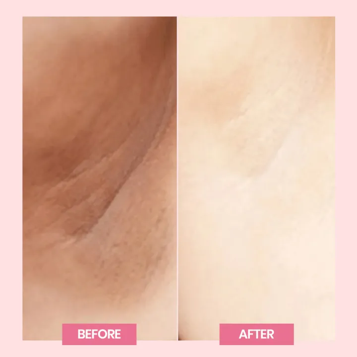 Wisdom%20Therapeutics%20Reborn%20Cream%20Advanced%20White%20Beauty%20Skin%20Cream,%20Night%20Cream,%20Brightening%20Cream%20for%20Private%20Parts%20&%20Lightens%20Uneven%20Skin%20Tone%20-%20Image%205