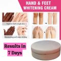 FORT Hand & Feet Whitening Cream – Whitens, Softens & Protects in 7 Days. 
