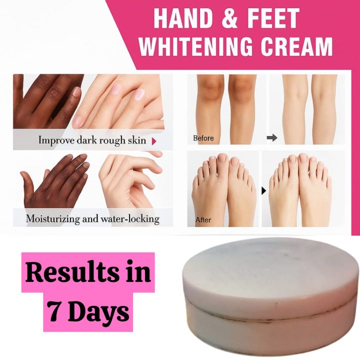 FORT Hand & Feet Whitening Cream – Whitens, Softens & Protects in 7 Days