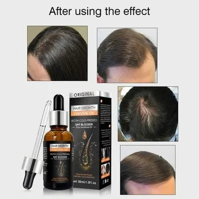 Pei%20Mei%20Hair%20Growth%20Essential%20Oil%20%E2%80%93%20Anti%20Hair%20Fall,%20Fast%20Hair%20Regrowth,%20Strengthening%20&%20Nourishing%20Scalp%20Treatment%20Serum%20for%20Men%20&%20Women%20-%20Image%206