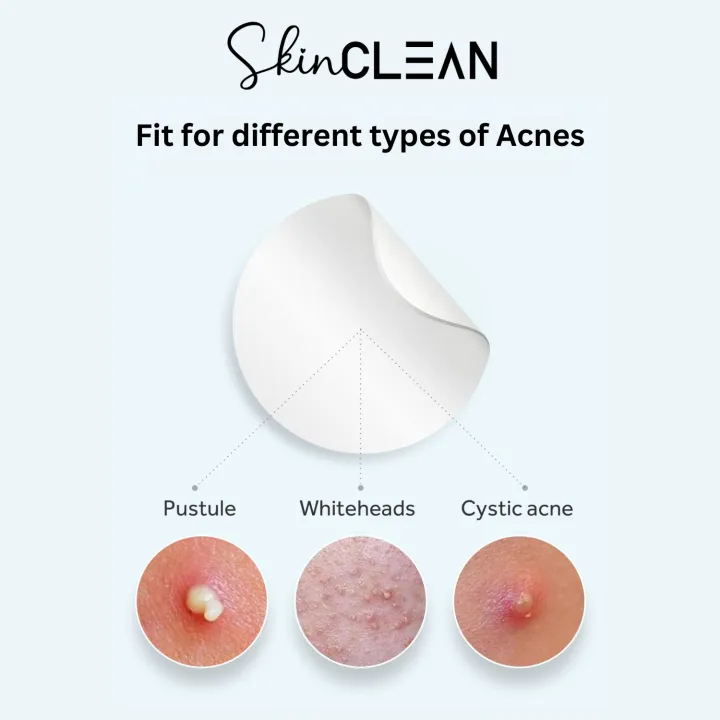 SKINCLEAN%20(48%20Count)%20Pimple%20Patches%20Acne%20Hydrocolloid,%20Clear%20Blemish%20Stickers,%20infused%20with%20Salicylic%20Acid%20&%20Tea%20Tree%20Oil,%20Waterproof,%20Mighty%20Miracle%20Face%20Patch,%203%20sizes%20(8-10-12mm)%20-%20Image%208