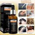Pei Mei Hair Growth Essential Oil – Anti Hair Fall, Fast Hair Regrowth, Strengthening & Nourishing Scalp Treatment Serum for Men & Women. 