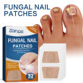 32Pcs Nail Treatment Patch Anti Fungal Nail Correction Stickers Ingrown Toenail Care Paronychia Anti Infection Repair Patch Yao Store. 