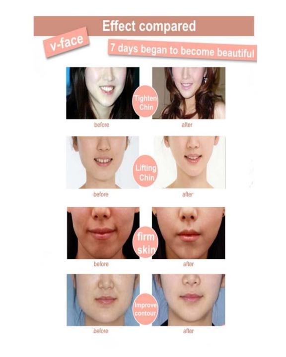 Face%20Lift%20Up%20Belt%20-%20Black%20-%20Image%206