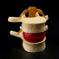 Lumbar Vertebrae Model Anatomical Spine Lumbar Disc Herniation Anatomy Teaching Tool Lumbar Vertebrae Model. 