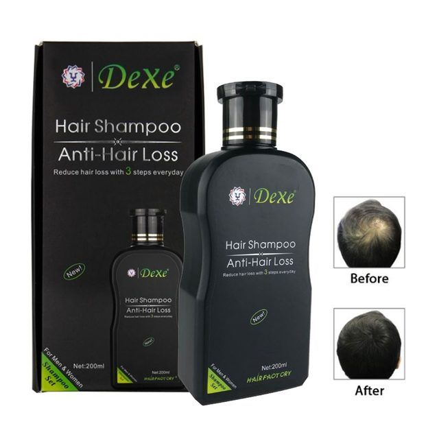 Dexe Anti Hair Loss Shampoo - 200ml (FOR MEN & WOMEN BOTH)