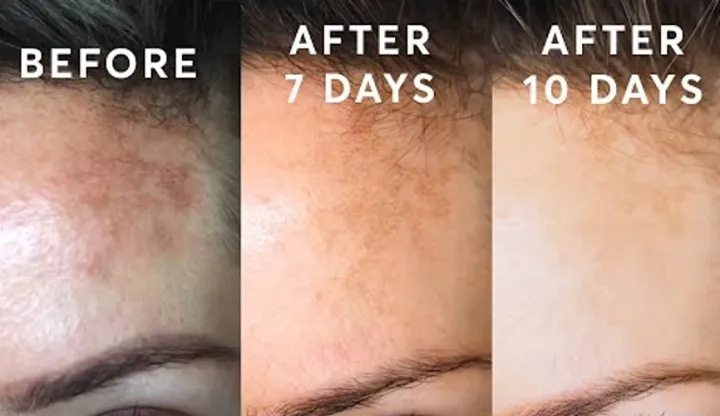 Trimo-Skin%20Face%20Beauty%20Cream%20Ideal%20for%20All%20Skin%20TYpes%20It%20is%20100%25%20safe%20to%20use%20as%20it%20has%20no%20side%20effects%20-%20Image%204