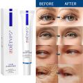 Eye Cream Instant Anti Aging Remove Dark Circles Wrinkle Removal Bags Puffiness Fade Eye Fine Line Skin Face Tighten Korean Care. 