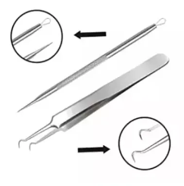 STAINLESS%20STEEL%20CURVED%20BLACKHEAD%20ACNE%20CLIP%20PIMPLE%20COMEDONE%20REMOVER%202PCS%20-%20Image%202