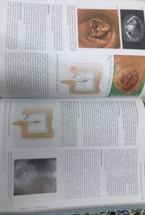 Bailey%20&%20Love%20Short%20Practice%20of%20Surgery%2026th%20edition%20-%20Image%203