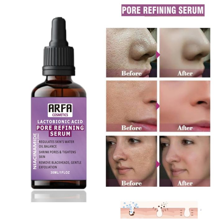 Arfa%20Cosmetics%20Pack%20OF%203%20Whitening%20Serum%20PORE%20REFINING%20Serum%20Niacinamide%20&%20Glycolic%20Acid%20Salicylic%20Acid%20Anti%20Acne%20Serum%20FREE%20DELIVERY%20-%20Image%203