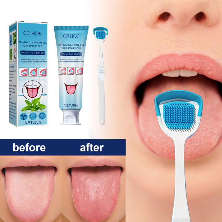 EELHOE%2050g%20Tongue%20Cleaning%20Gel%20with%20Brush%20Oral%20Care%20Removal%20Odor%20Health%20Fresh%20Breath%20Dental%20Hygiene%20Care%20Coating%20Cleaning%20Kit%20-%20Image%202