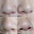 10pcs Nose Blackhead Remover Strips Mask Skin Care Shrink Pore Acne Treatment Mask Deep Nose Pore Cleansing Strips Black Head Remover. 