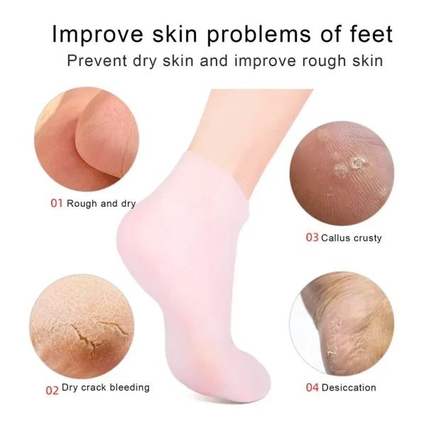Silicone%20Jelly%20Socks%20%7C%20Box%20Packed%20%7C%20Ultra-Moisturizing%20Gel%20Foot%20Care%20Protector%20-%20Image%206