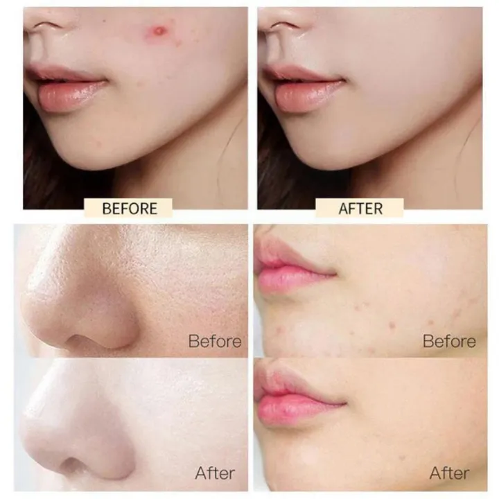 Trimo-Skin%20Face%20Beauty%20Cream%20Ideal%20for%20All%20Skin%20TYpes%20It%20is%20100%25%20safe%20to%20use%20as%20it%20has%20no%20side%20effects%20-%20Image%209