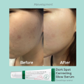 AXIS-Y Dark Spot Correcting Glow serum/50ml. 