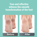 Electric Foot Callus Remover Power Source Cell Both Foot File Callus Remover Dead Skin Remover For Feet Professional Pedi Foot Care Pedicure Tools For Women Men Hard Cracked Dry Skin Finishing Touch Flawless Pedi File And Callus. 