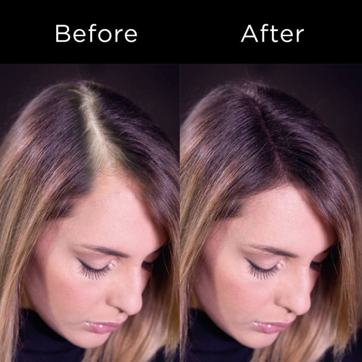 King%20Caboki%20hair%20Building%20fibers%2012g%20Medium%20Brown%20+%20King%20Caboki%20Hairline%20Optimizer%20Comb,%20Best%20Value%20&%20Superior%20Formula,%20Best%20affordable%20alternative%20Toppik,%20Caboki,%20xfusion,%20olivea%20Fibers%20-%20Image%203