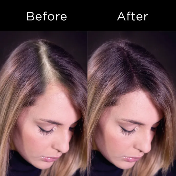 King%20Caboki%20hair%20Building%20fibers%2012g%20Medium%20Brown%20+%20King%20Caboki%20Hairline%20Optimizer%20Comb,%20Best%20Value%20&%20Superior%20Formula,%20Best%20affordable%20alternative%20Toppik,%20Caboki,%20xfusion,%20olivea%20Fibers%20-%20Image%203