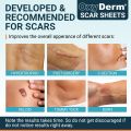 OxyDerm Scar Sheets Efficent Surgery Scar Removal Premium Medical Silicone Gel Sheet Size 4cm X 15cm - 5 pcs. 