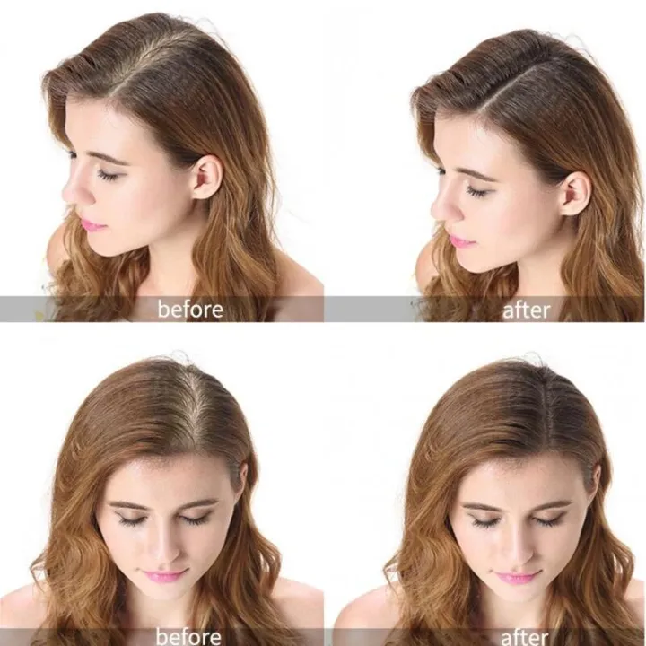 Refill%20Caboki%20Hair%20Building%20Fibers%2025%20Grams%20All%20Colors%20Available%20Caboki%20Dark%20Brown,%20Refill%20Bag%20Caboki%20Black,%20Refill%20Caboki%20Medium%20Brown,%20Refill%20Caboki%20Light%20Brown%20Caboki%20Hair%20Building%20Fibers,%20Fill%20In%20Fine%20or%20Thinning%20Hair%20Instantly%20Thicker%20Men%20&%20Women%20-%20Image%203