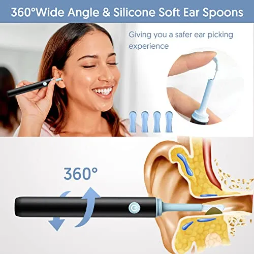 Smart%20Visual%20Ear%20Wax%20Cleaning%20Kit%20with%20Camera%20HD%20%E2%80%93%20Wireless%20Ear%20Cleaner%20Endoscope%20%E2%80%93%20Rechargeable%20Earwax%20Removal%20Tool%20with%20Soft%20Silicone%20Tips%20-%20Rechargeable%20HD%20Ear%20Camera%20with%20Mobile%20Display%20-%20Image%204