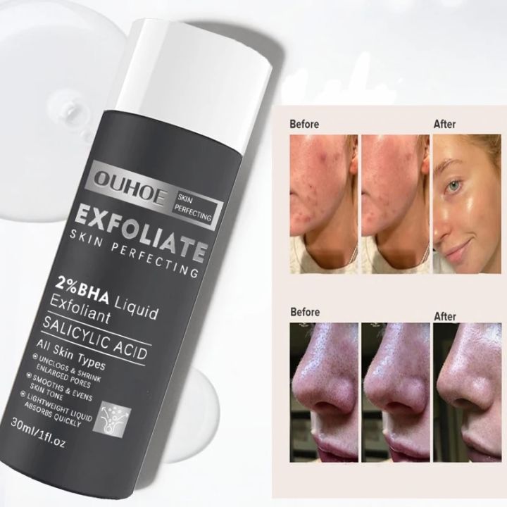 SKIN PERFECTING 2% BHA Liquid Salicylic Acid Exfoliant-Facial Exfoliant Blackheads Acne/Spot Removing Face Serum 30ml