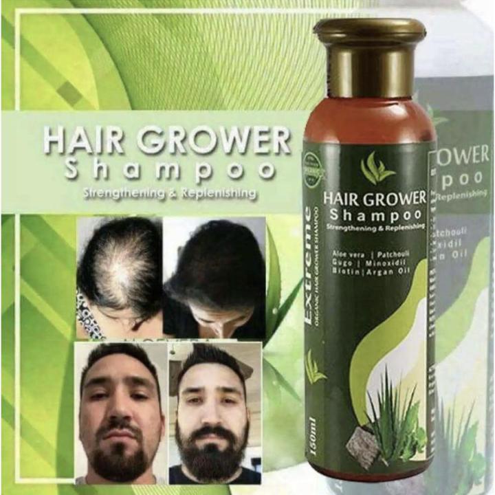 SUNISA%20Hair%20Grower%20Prestige%20Organic%20Extreme%20Aloe%20Vera%20Hair%20Grower%20Shampoo%20QB/T2872%20150%20ml%20-%20Image%207