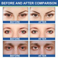 Eye Protection Ointment Herbal Improve Eyesight Treatment Cataract Myopia Glaucoma Relieve Eye Fatigue Dry Itchy Eye Care Cream. 