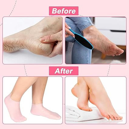 One%20pair%20of%20silicone%20socks,%20moisturizing%20gel%20heel%20socks,%20a%20silicone%20heel%20pad%20for%20your%20feet,%20and%20a%20multifunctional,%20unisex%20shoe%20-%20Image%207