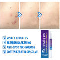 Wart Removal Pen – Liquid Treatment for Hand & Foot Warts. 