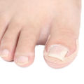 20pcs ingrown toenails band Aid relief pain Paronychia correction pedicure Elastic Force Sticker Repair bandage toe nail care. 