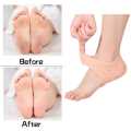 1 Pair Squishy Soft Silicone Moisturizing Heel Socks Feet Skin Care Anti Crack Control Foot Protecto ... 