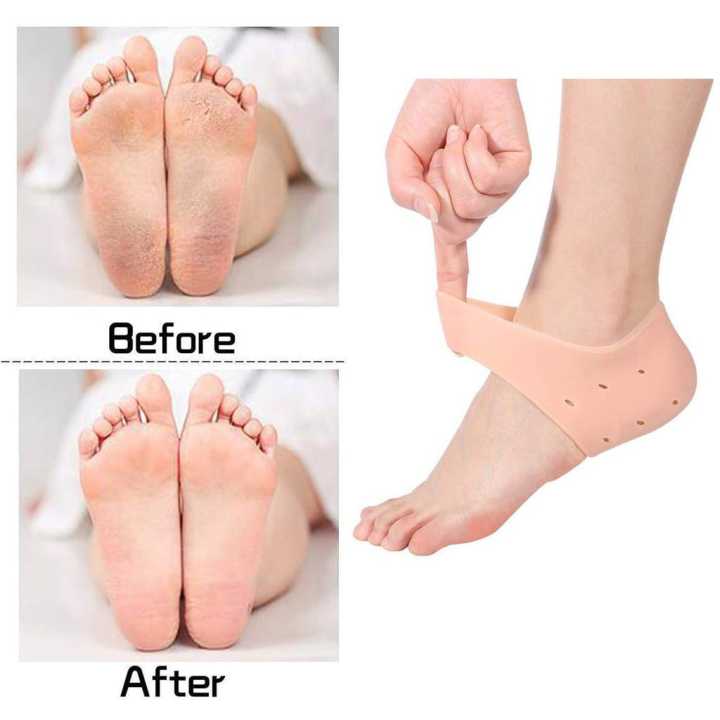 1%20Pair%20(2pcs)%20Soft%20Silicone%20Heel%20Anti%20Crack%20for%20Pain%20Relief%20Silicone%20Gel%20Heel%20Pad%20Socks%20for%20Men%20and%20Women%20Heel%20Protector%20-%20Image%209