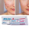 Skin-A Cream Tretinoin Cream for Clear, Acne-Free Skin. 