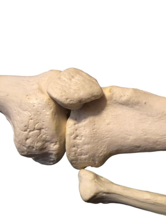 Human%20Lower%20Limb%20Loose%20Bones%20Set%20%7C%20Adult%20%7C%20Large%20Size%20%7C%20PVC%20-%20Image%204