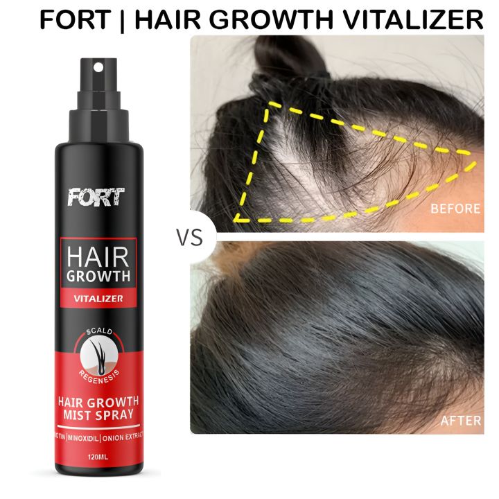 FORT  Minoxidil Hair Growth Spray - Hair Tonic for Hair Care and Hair Growth - Premium Hair Care ProductWomen and Men all Hair Types