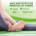 Foot Corn Remover Cream Chicken Eye Skin Infection Treatment Ointment Feet Dead Skin Calluses Removal Tool Health Care. 