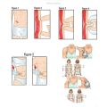 1Pcs Crossfit Body Fat Loss Tester Calculator Fitness Caliper Clip Measurement Slim Skin Fold Body Fat Chart Gym Equipment. 