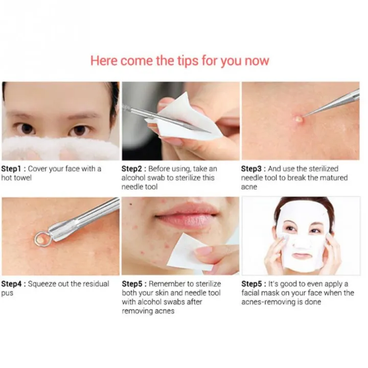STAINLESS%20STEEL%20CURVED%20BLACKHEAD%20ACNE%20CLIP%20PIMPLE%20COMEDONE%20REMOVER%202PCS%20-%20Image%205